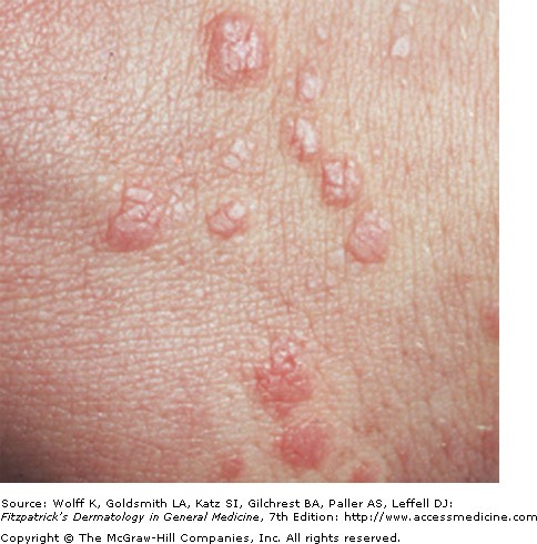 Dermatological Terms: Microscopic and Macroscopic ...